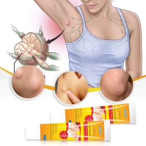 Chinese Herbal Lymph Nodes Care Ointment Lymphatic Inflammation Lumps Swelling Balm Drainage Detox Cream