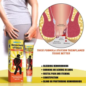 Chinese Natural Anti-Itch Herbs Herbal Hemorrhoids Ointment Cream