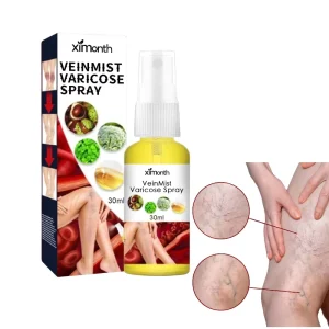 Chinese Products Varicose Vein Spray Natural Herbal Ingredients Relieve Leg Discomfort Relaxing Veins