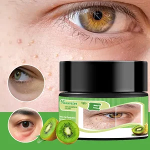 Cross border Explosions Foreign Trade Vitamin E Fat Cream Bottled 30g Fruit Acid Moisturizing Eye Skin Care Solution Made China