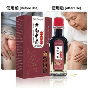 Essential Balm Gel Oil Herbal TCM for Back Waist Knee Shoulder Feet & Arthritis Pain Relief External OEM
