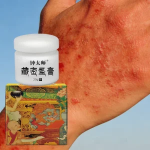 Herbal herpes care cream anti itching antibacterial moisturizing itchy hands and feet peeling blister gel