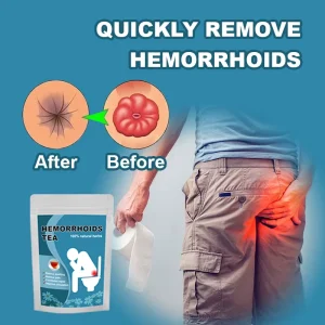 Natural Hemorrhoid Support Herbal Tea Gentle Body Circulation Care for Reduce Swelling & Recurrence