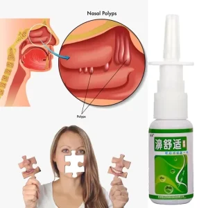 OEM Chinese Traditional Herb Spray Nasal Sprays Nose Care Health Care ODM