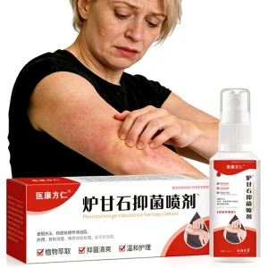 OEM Herbal Damp Toxic Relief Spray for Soothes Rashes Prickly Heat and Skin Itchiness 60ml Body Skin Daily External Care