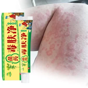 Oem odm natural Chinese herbal eczema cream hot product itching dermatophyte antipruritic ointment