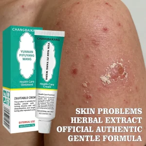 Outdoor Activity Itching Patch Mosquito Bite Children’s Skincare Cream Herbal Paste Pure Natural External Use