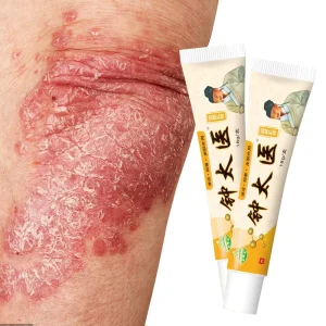 Tinea Dermatitis Ointment OEM External Application Chinese Herbal Medicine 18g Antibacterial Support Customized