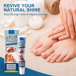 Toenail Care Cream 20g Herbal Nourishing Balm Vitamin E Nail Wellness Soothing Ointment Factory Direct