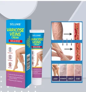 Vein Repair Cream for Leg Meridian Care Antibacterial Sustainable 0%-5% Active Ingredients Non-Toxic Made in Jiangxi